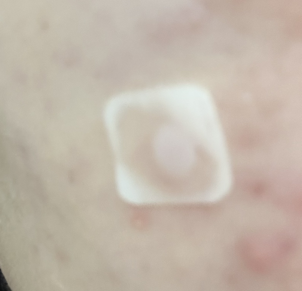 局部护理贴膏套装[红斑]的真实用户使用照片