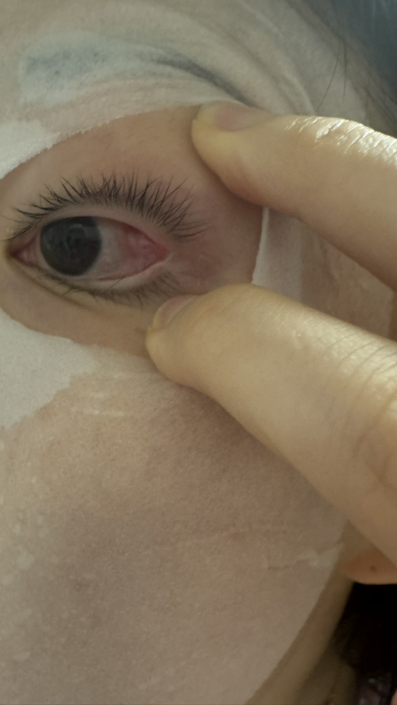 더마펌 (DERMAFIRM) 수딩 리페어 마스크 R4 review image