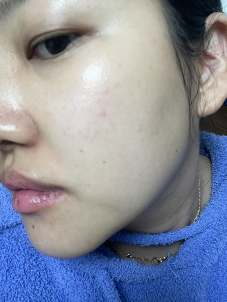 皇家蜂蜜丰富的蜂胶精华的真实用户使用照片