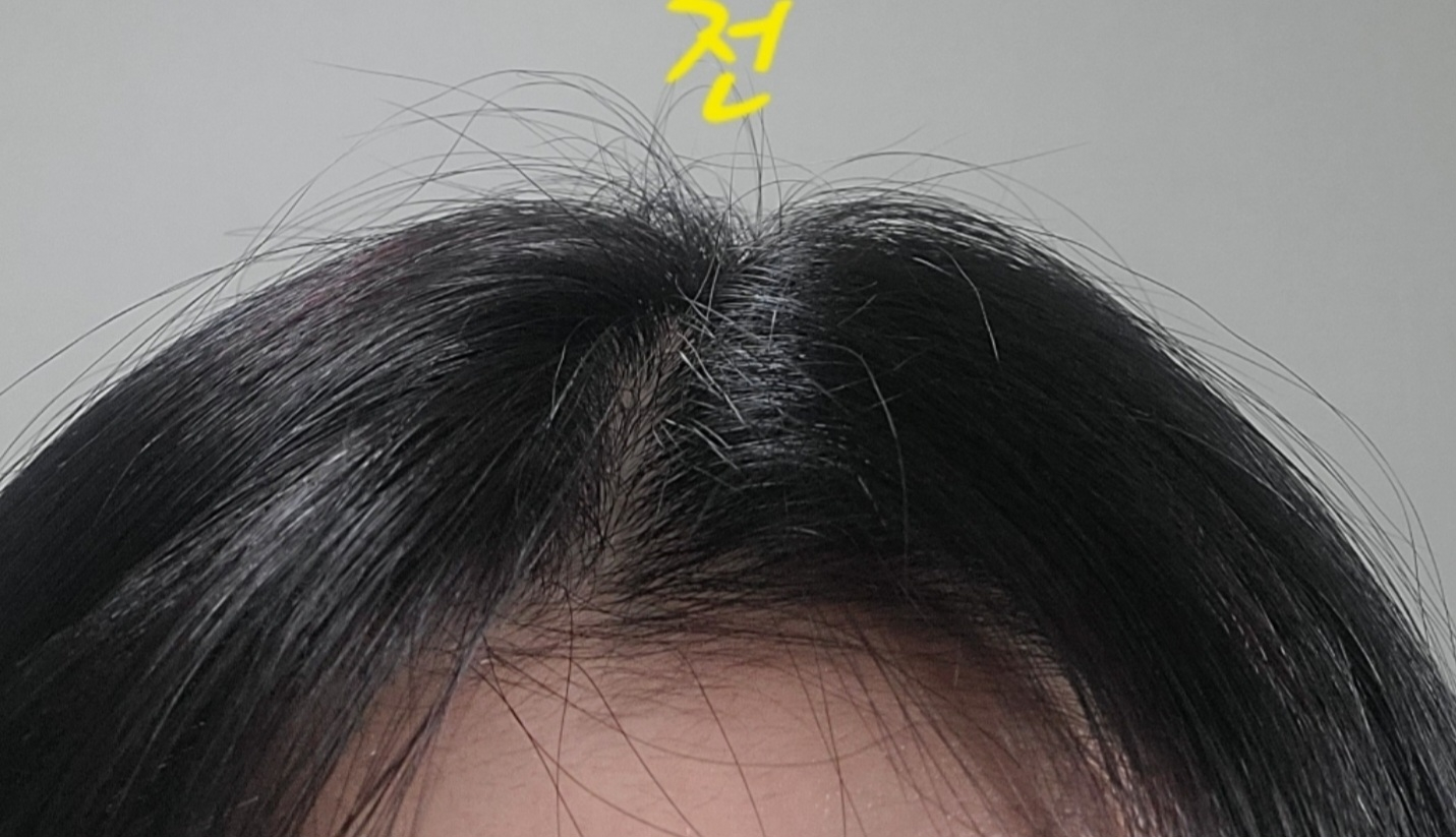 모에타 (moeta) 잔머리 픽서 review image