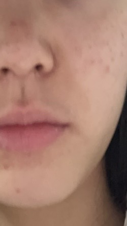 Real user review photo of ceramide ato concentrate cream