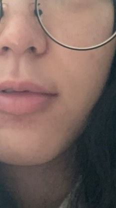Real user review photo of ceramide ato concentrate cream
