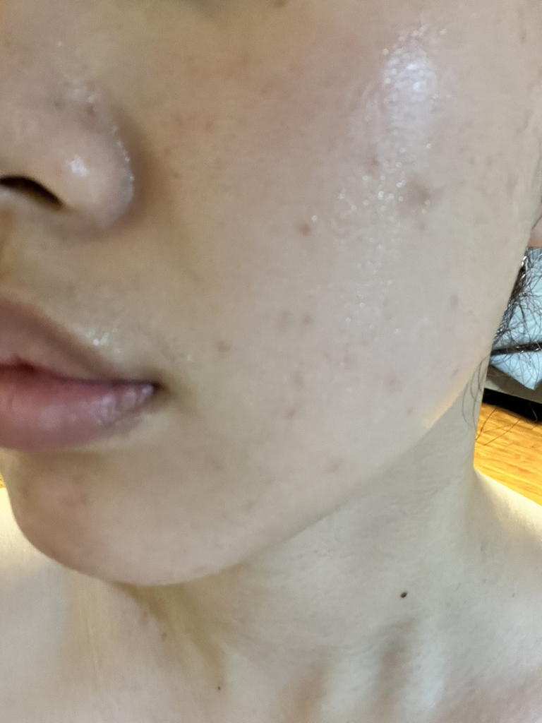 어나더페이스 (ANOTHERFACE) 펩타테놀 수분 밸런스 겔 마스크 review image