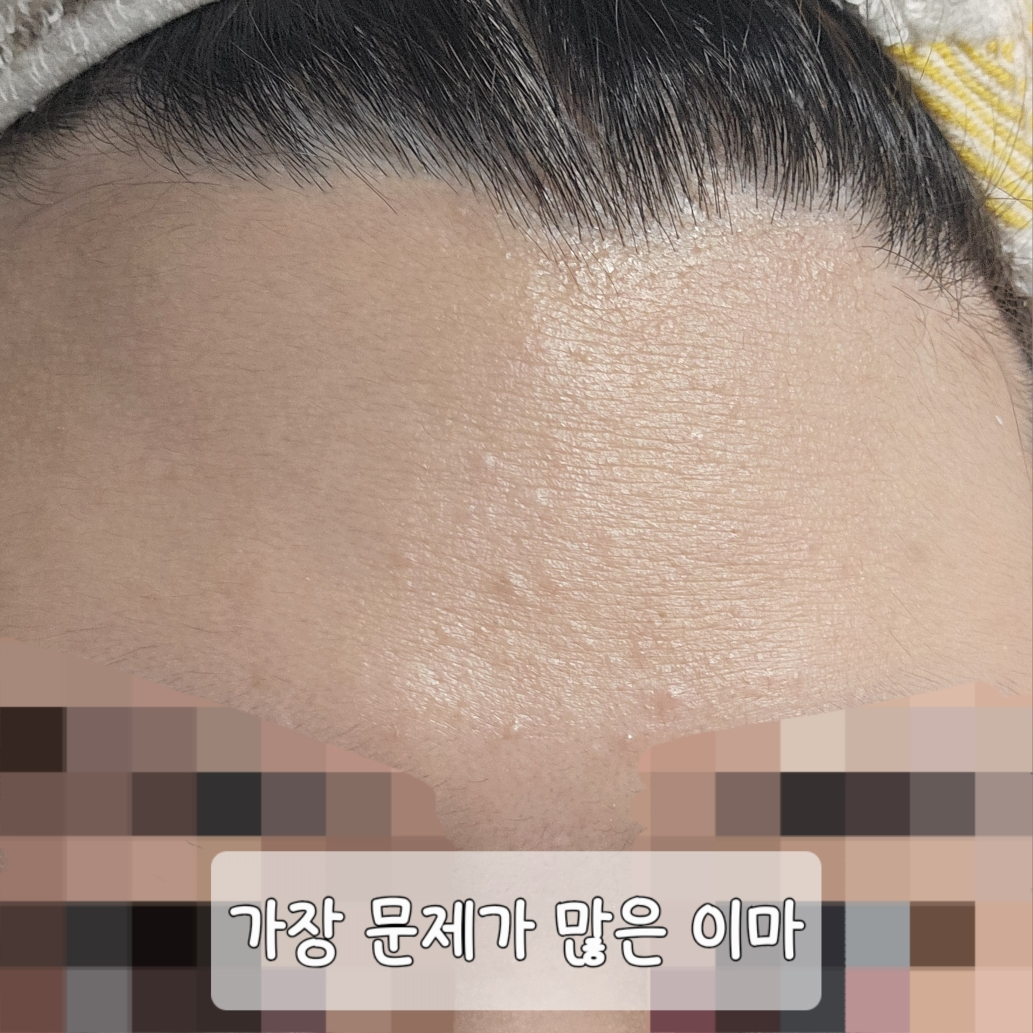 구달 (goodal) 청귤 비타C 잡티케어 세럼 review image