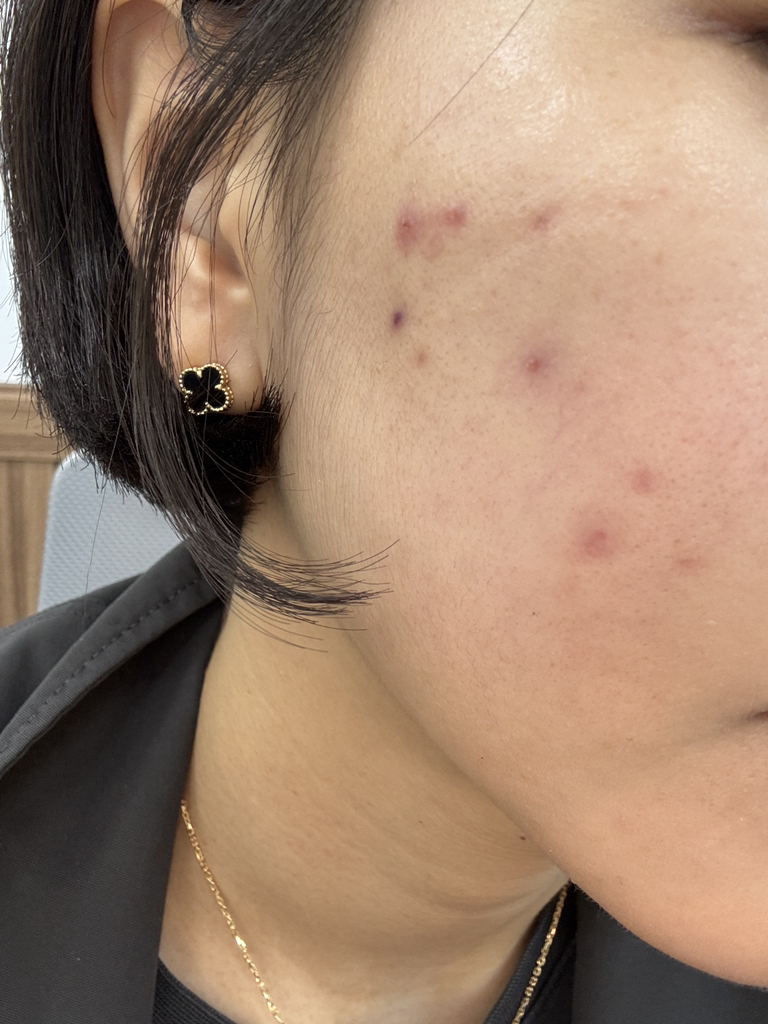 이니스프리 (INNISFREE) 그린티 히알루론산 진정수분 선세럼 [SPF50+/PA++++] review image