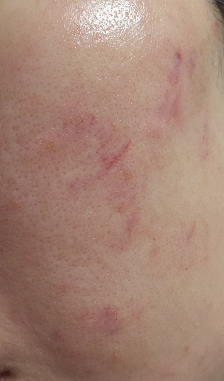 复颜滚筒安瓿的真实用户使用照片