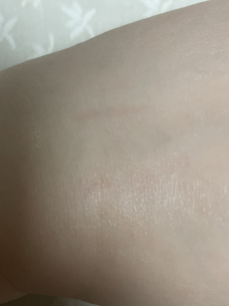 Real user review photo of DIVE IN Low Molecular Hyaluronic Acid Cleansing Water