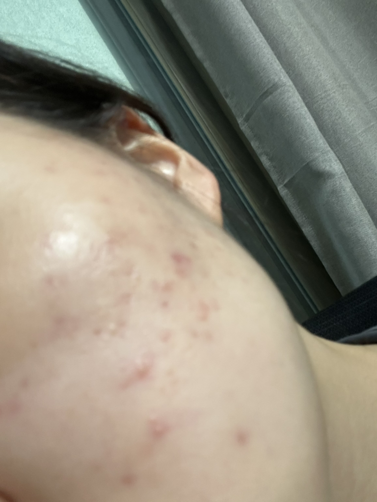 水米洁面膏的真实用户使用照片