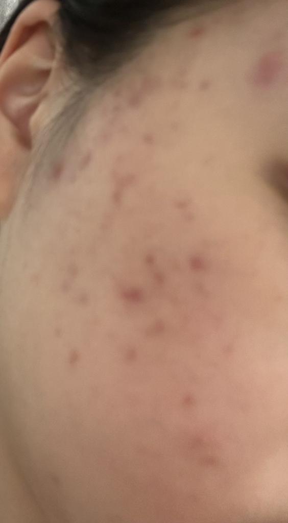 水米洁面膏的真实用户使用照片