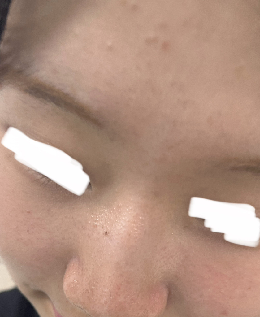 水润医生安瓿的真实用户使用照片