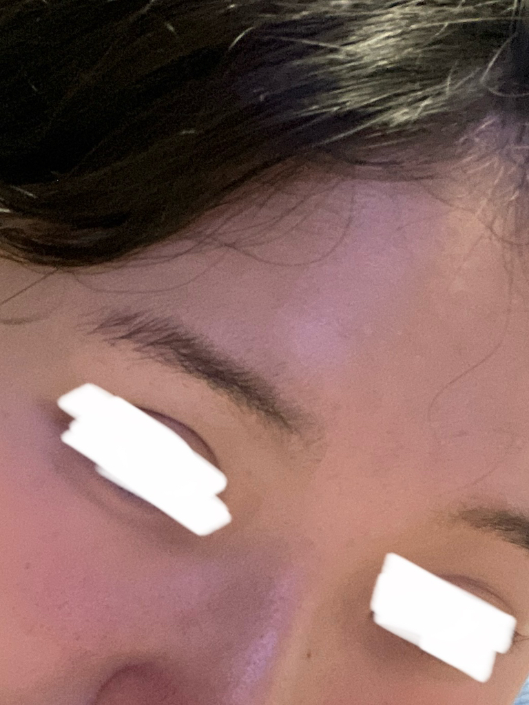 水润医生安瓿的真实用户使用照片