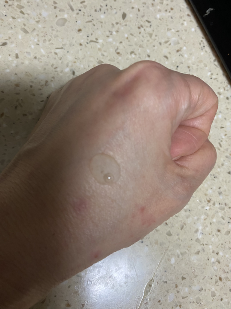安琪尔水润舒缓安瓶的真实用户使用照片