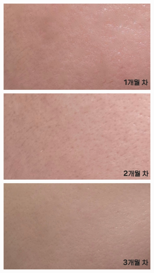 Real user review photo of EPL CURE CREAM XD