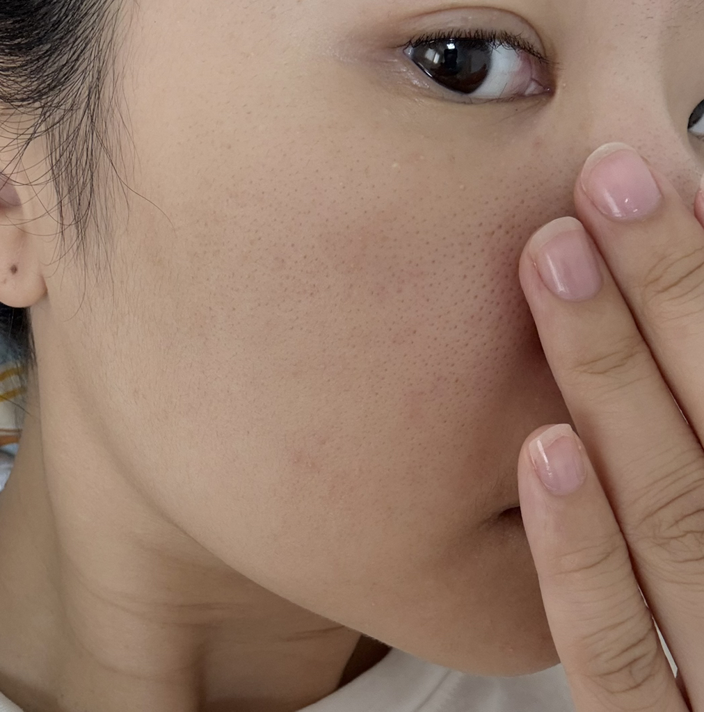 Real user review photo of A-CICA365 BLEMISH CALMING SERUM