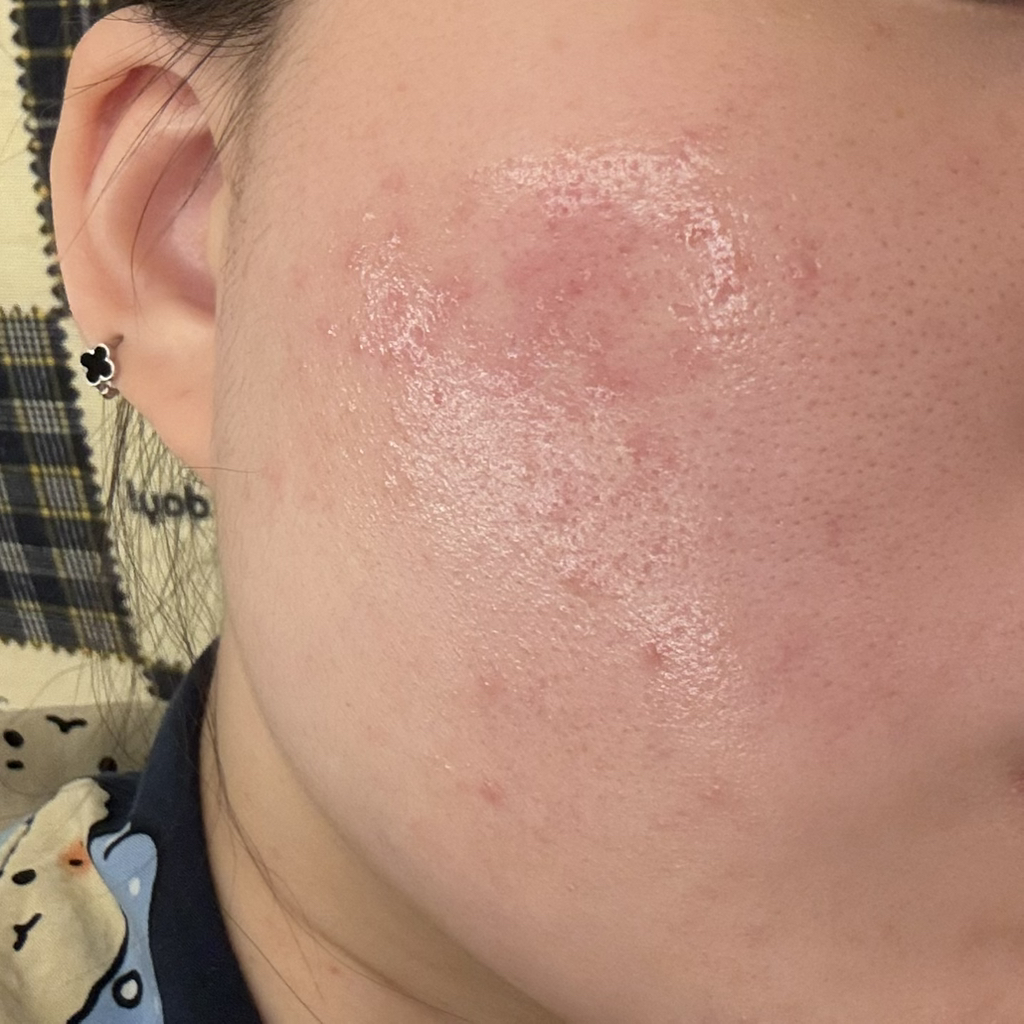 SIDMOOL SKINSOURCE D-PANTHENOL AMPOULE review image