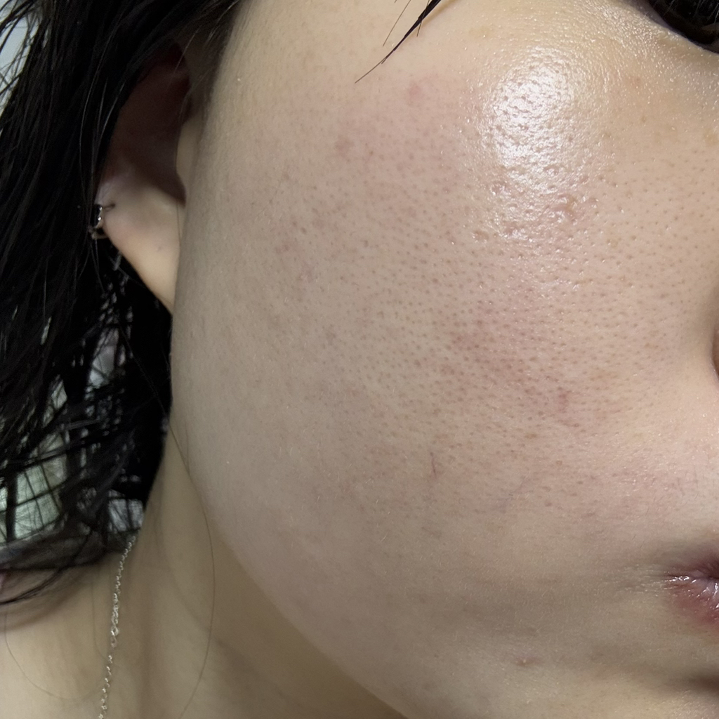 SIDMOOL SKINSOURCE D-PANTHENOL AMPOULE review image