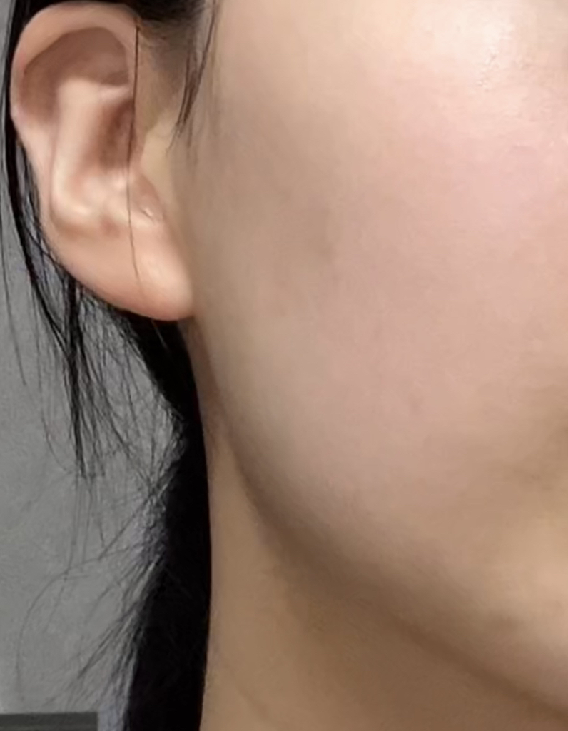메디테라피 (MEDITHERAPY) 트라넥삼산 흔적 크림 review image