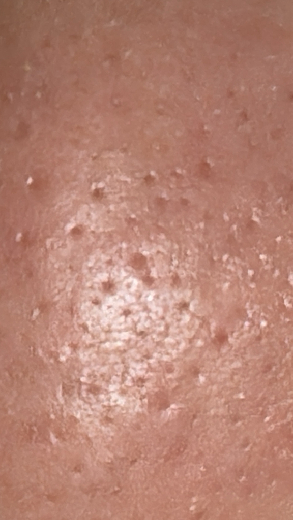 beplain MUNG BEAN PORE SCALING WATER review image