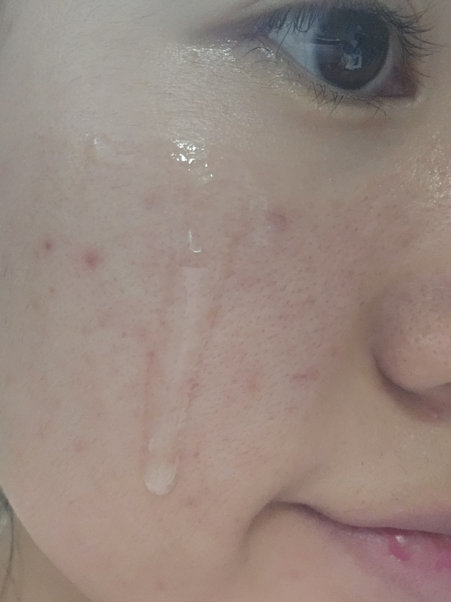 리쥬란코스메틱 (REJURANCOSMETICS) 힐러 턴오버 앰플 듀얼 이펙트 review image