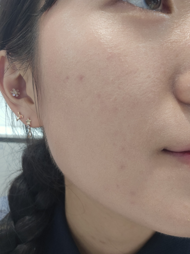 리쥬란코스메틱 (REJURANCOSMETICS) 힐러 턴오버 앰플 듀얼 이펙트 review image