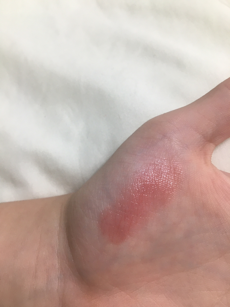 润唇疗护唇膏 [粉嫩桃]的真实用户使用照片