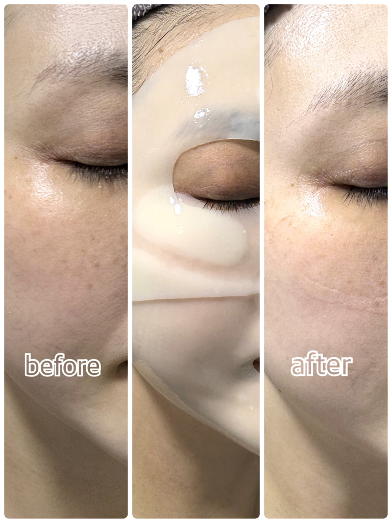 웰더마 (WellDerma) 프리미엄 시카 트리트먼트 리페어 피팅 마스크팩 review image