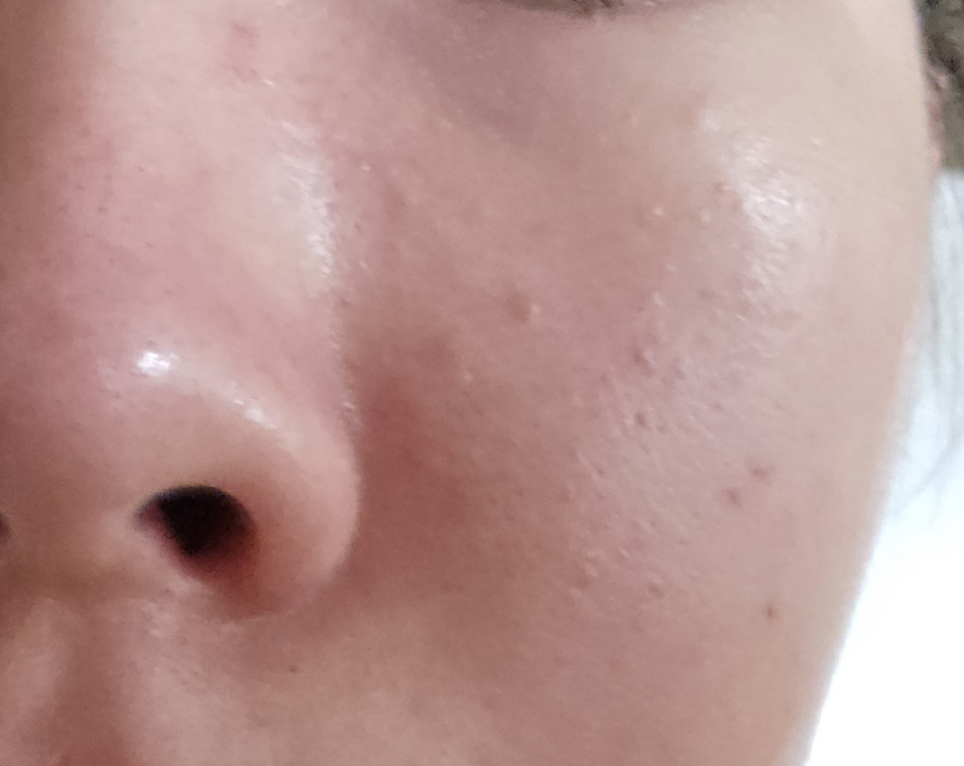 medicube (美蒂秋芙) 红色调理液 2.0 common.review image