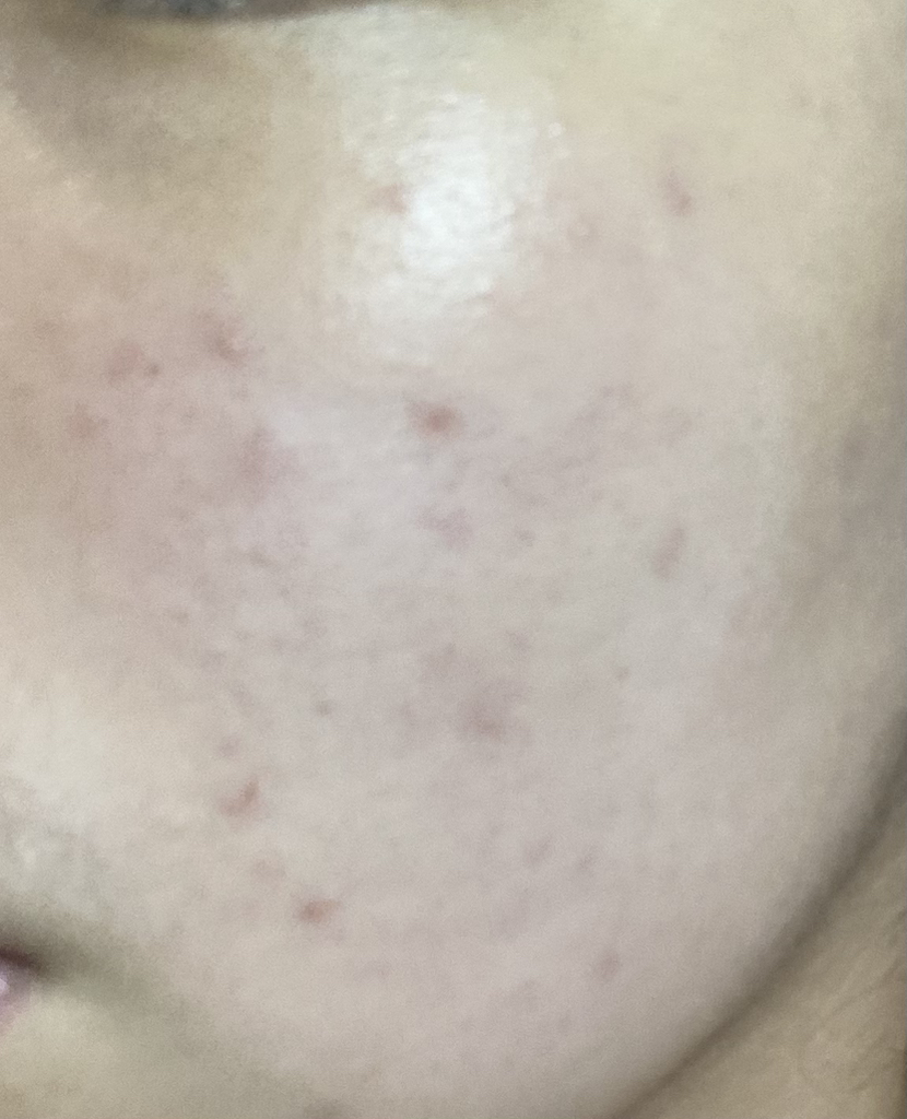 粉底液 SPF50+/PA+++ [22号 遮瑕色]的真实用户使用照片