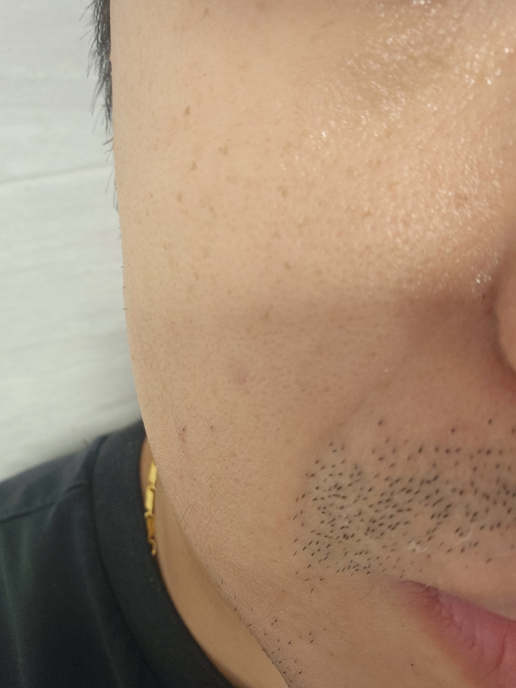 深层美白安瓿的真实用户使用照片