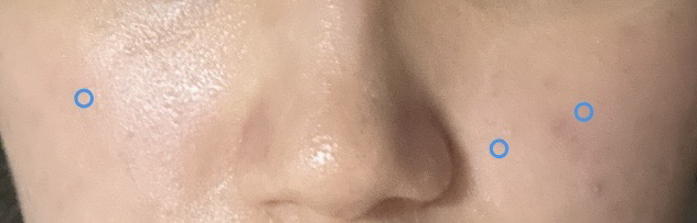 皇家白松露密集精华液的真实用户使用照片