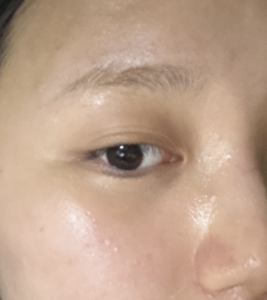 祛痘修护精华的真实用户使用照片