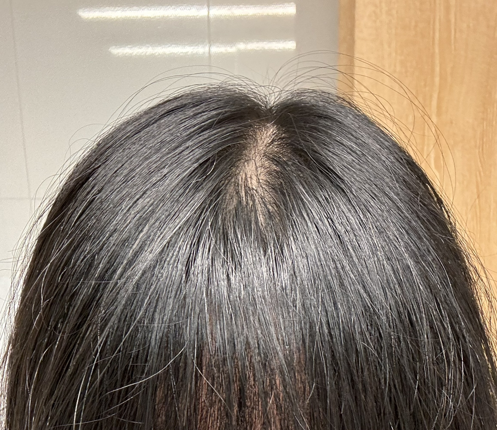 모에브 (moev) 아누카틴 샴푸 review image