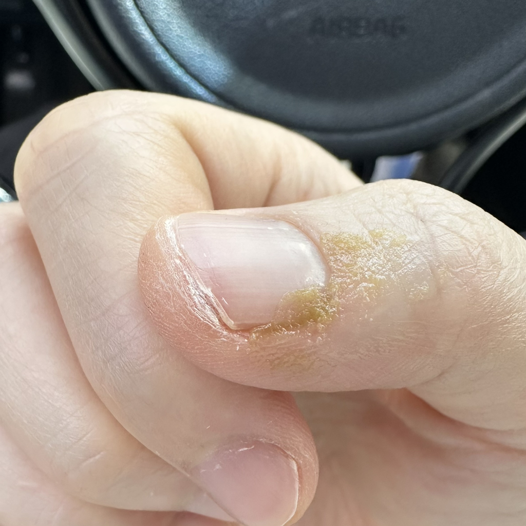 버츠비 (BURT'SBEES) 레스큐오인트먼트 시카 스틱 review image