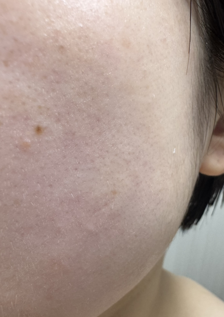디퍼 (DPPR) 히알큐브 플러딩 크림 review image