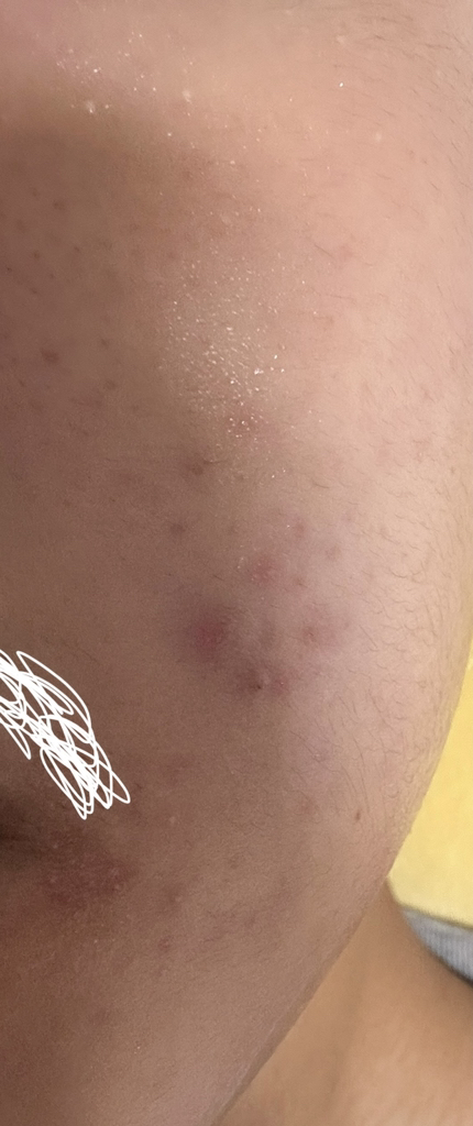 零油控制乳液的真实用户使用照片