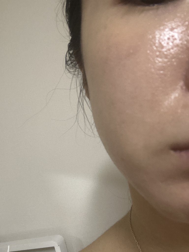 메디테라피 (MEDITHERAPY) 포쎄라 샷 엑소좀 스피큘 세럼 review image