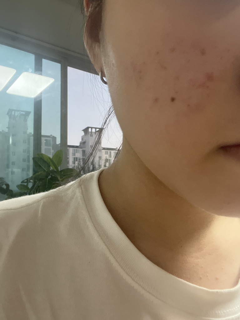 密集遮瑕粉底液 [SPF30/PA++] [21号 浅米色]的真实用户使用照片