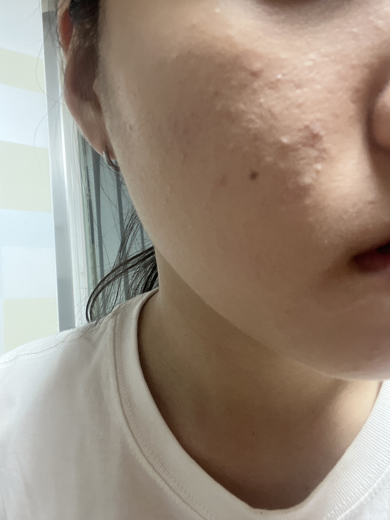 密集遮瑕粉底液 [SPF30/PA++] [21号 浅米色]的真实用户使用照片