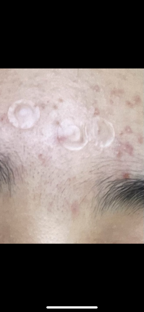 弱酸性保湿乳霜的真实用户使用照片