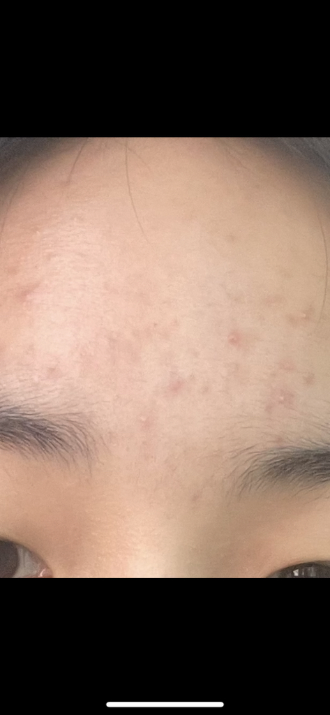 弱酸性保湿乳霜的真实用户使用照片