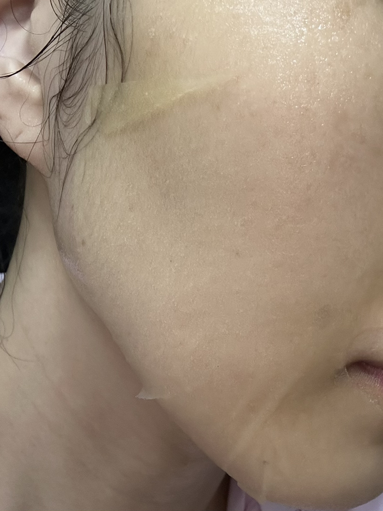 이니스프리 (INNISFREE) 비타민C 세럼 겔 마스크 review image