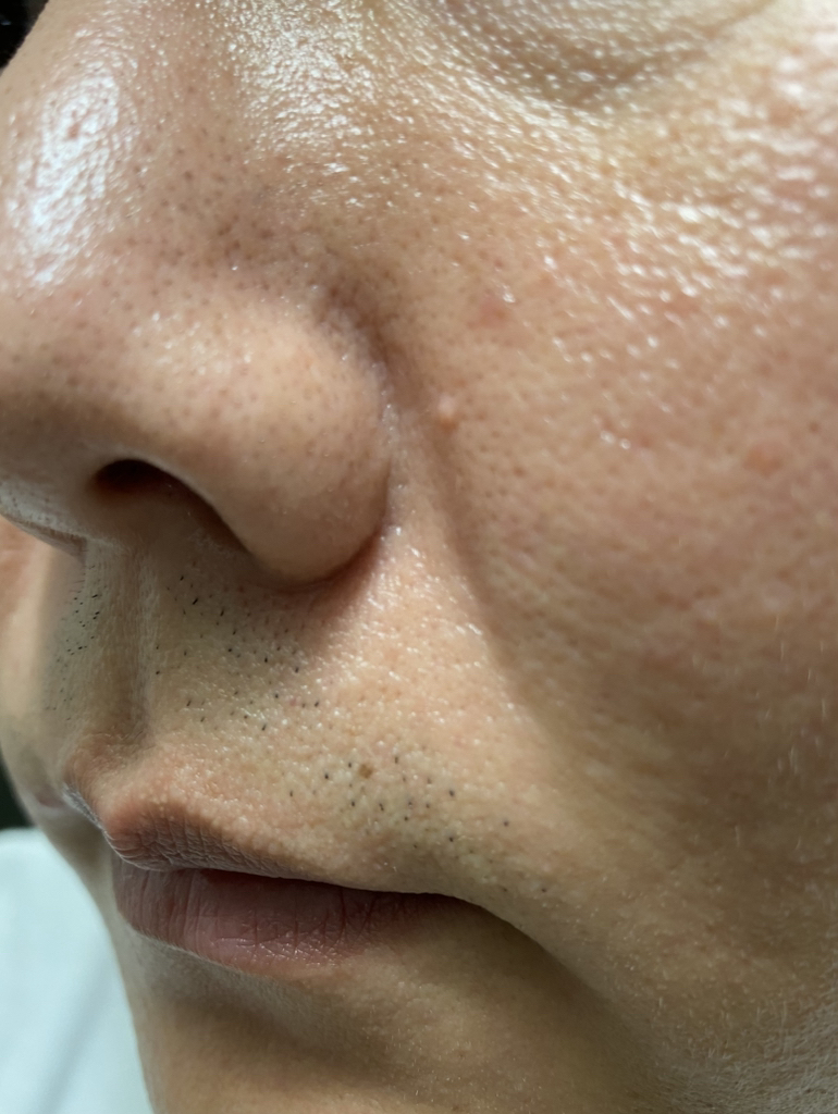 Clinfinite 黑盐木炭深层毛孔泡沫洁面乳 review image