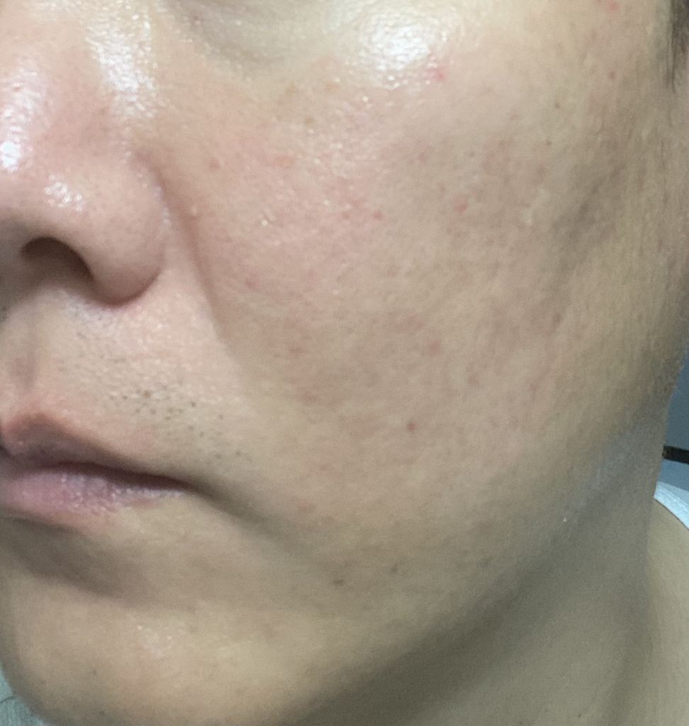 Clinfinite 黑盐木炭深层毛孔泡沫洁面乳 review image