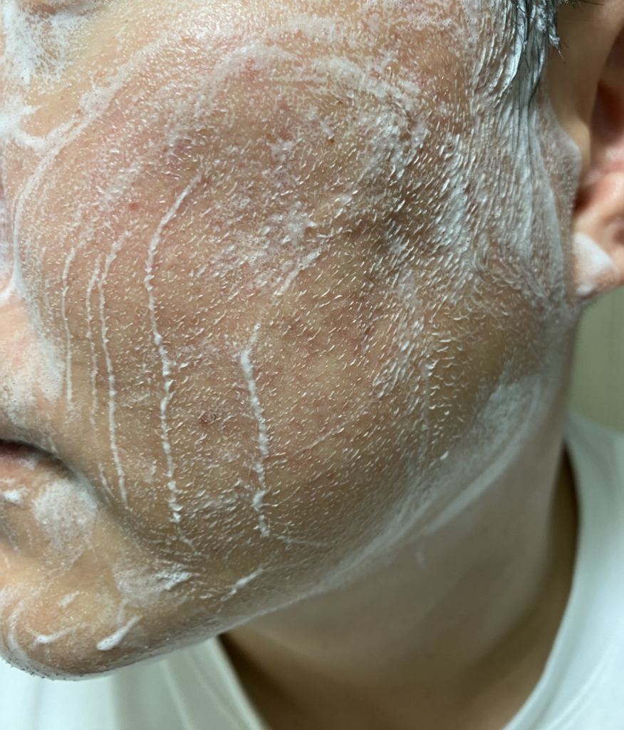 클린피닛 (Clinfinite) 블랙솔트 앤 차콜 딥 포어 폼 클렌저 review image