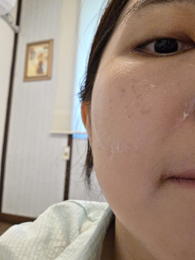 프란츠 (FRANZ) 네이키드 선쉴드 펩타이드 패치 review image