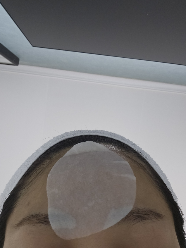 硅酸盐祛痘面膜的真实用户使用照片