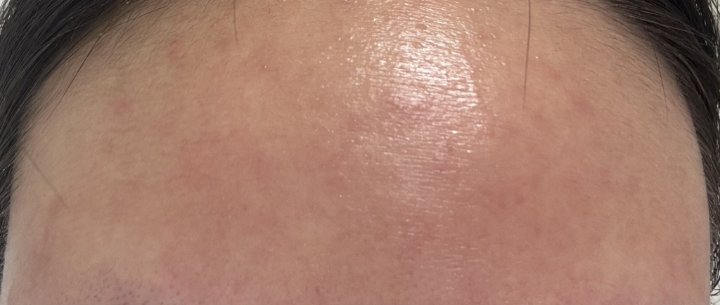 泛特赛尔修复保湿乳霜喷雾的真实用户使用照片
