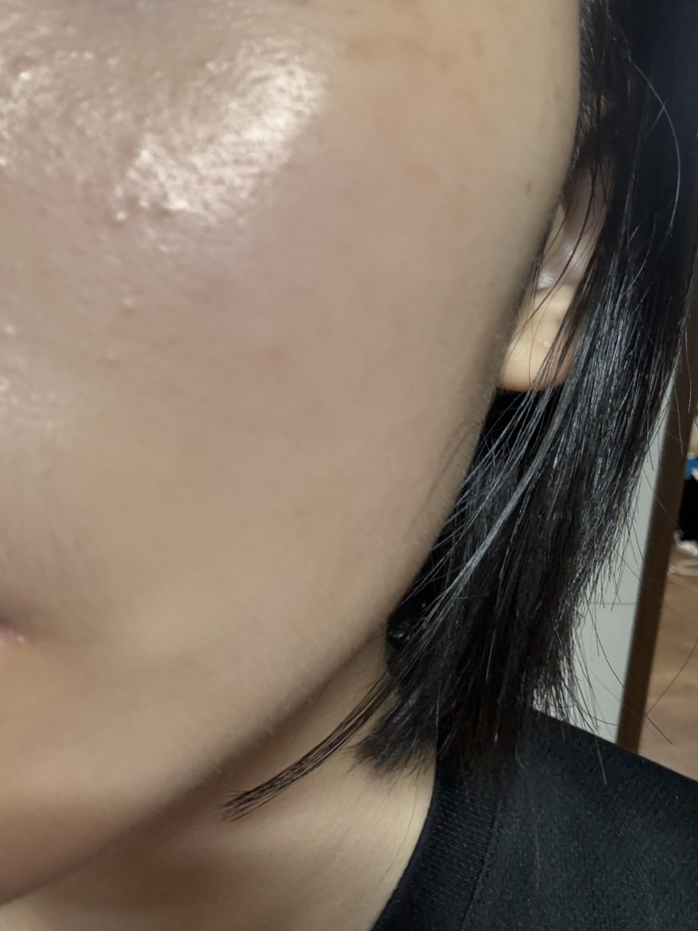 维生素C绿茶酶斑淡化调理面膜的真实用户使用照片
