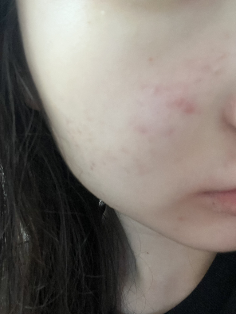 makep:rem (美科富来) 因特卡舒缓垫 common.review image