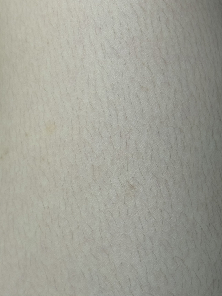엠락틴 (AMLACTIN) 데일리 릴리프 락틱애씨드 12% 바디로션 review image